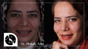 ما هي طرق علاج آلام الفك؟
