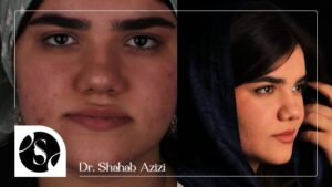 علاج صوت طقطقة الفك في عيادة الدكتور شهاب الدين عزيزي