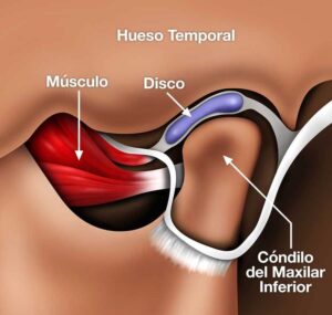 ما هي أنواع مشاكل المفصل الصدغي الفكي؟
