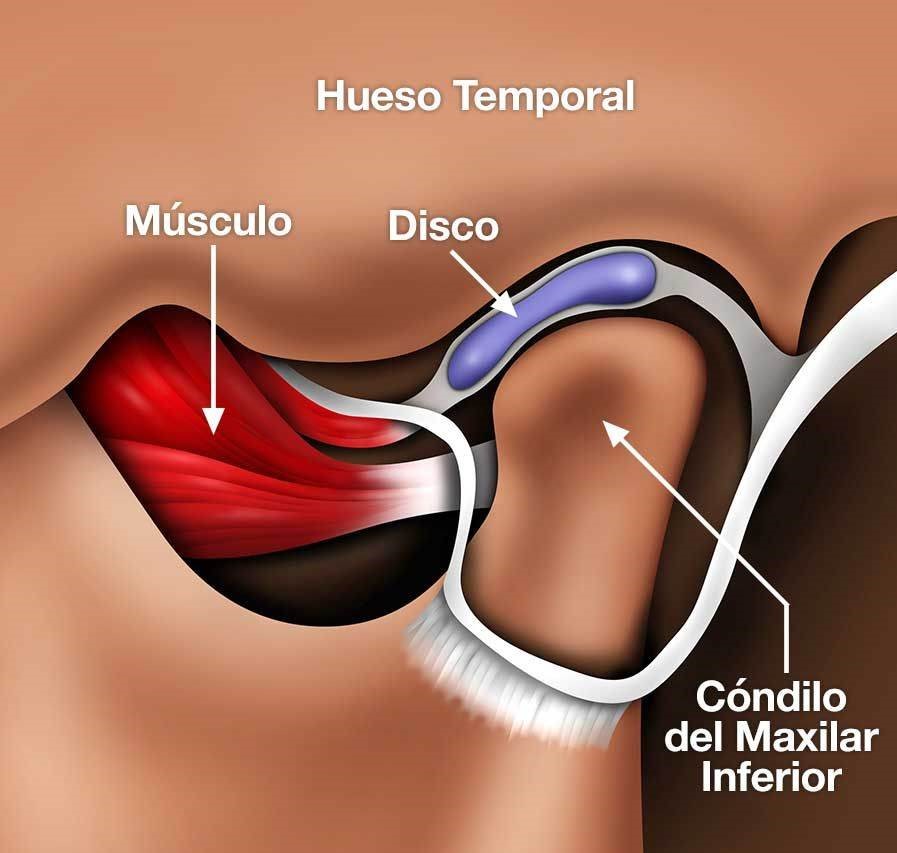 ما هي أنواع مشاكل المفصل الصدغي الفكي؟