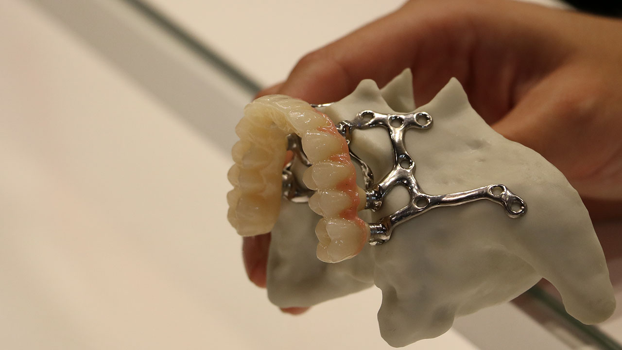 ما هي عملية زراعة الفك تحت السمحاق ومن هي المناسبة لها؟