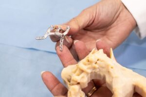 طبعة الفك لتصنيع غرسة الفك تحت السمحاق